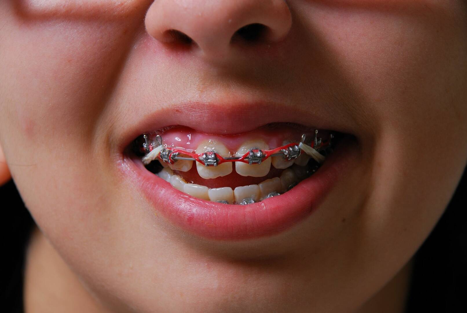 Cruz Davis Family and Cosmetic Dentistry